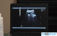 Horny doctor wolf anal fuck his petite gay patient